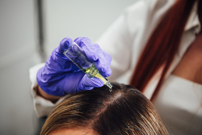 Mojevlasy.cz - Mezoterapie